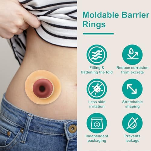 Vlookup ostomy rings demonstrated being gently stretched and shaped for custom body contouring.