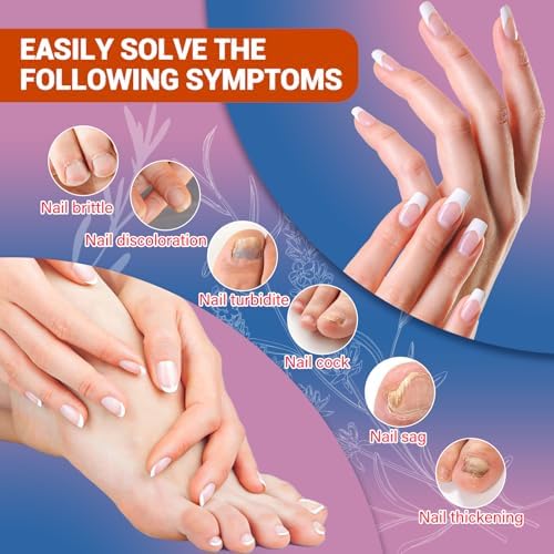 HULEIWA professional strength nail fungus remover application process