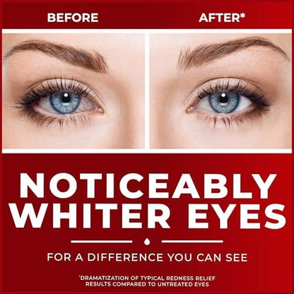Clear Eyes maximum strength lubricant drops for dry and red eyes.