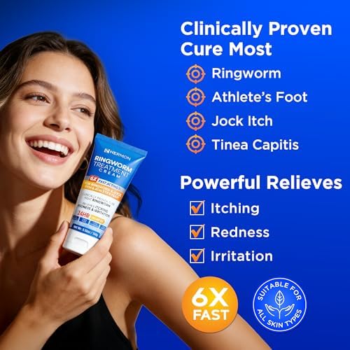 Hermon tinea versicolor relief ointment showing the tube texture and premium imported packaging quality