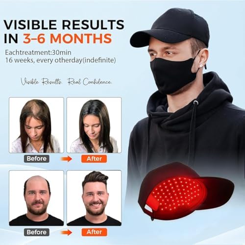 Person wearing Yuxian hair growth cap for scalp health
