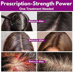 Side profile of Euphea Ivermectin 0.5% lotion 2 fluid ounce bottle