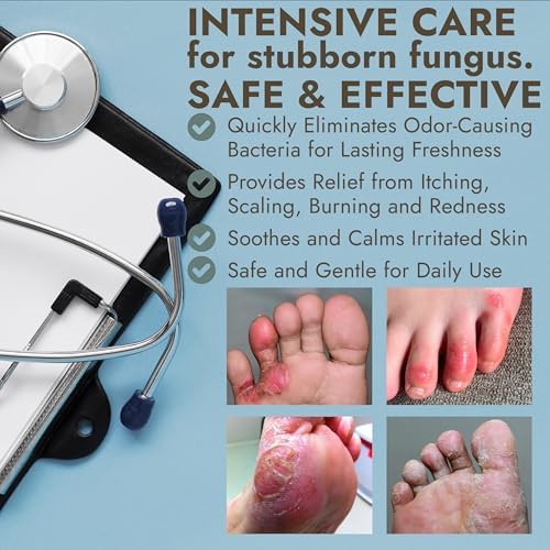 Fast absorbing antifungal spray for athlete's foot and nail fungus