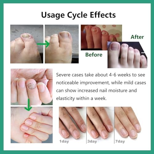 Authentic Nutraboost nail treatment packaging angle view