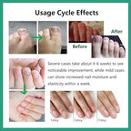 Authentic Nutraboost nail treatment packaging angle view