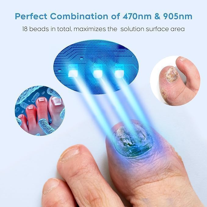 ZZP nail repair light device showing the U-shaped opening for fingers.