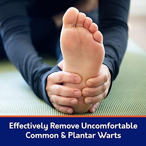 Contents of the plantar wart kit including pumice file and comfort pads.