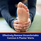 Contents of the plantar wart kit including pumice file and comfort pads.