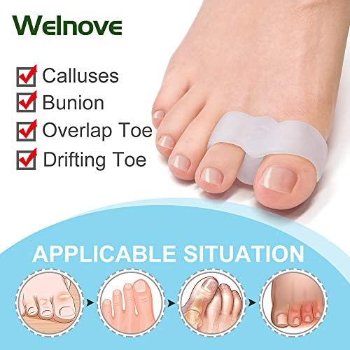 Medical grade silicone big toe spacers for bunion pain relief.