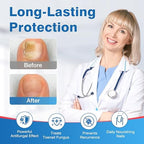Safefight antifungal liquid pens showing the rotating brush tip