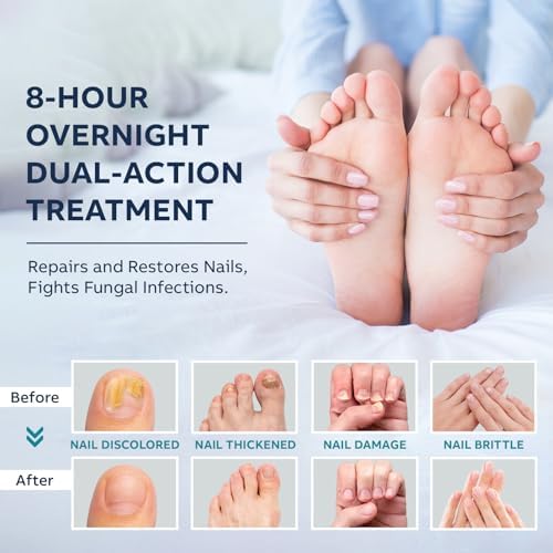 Osimoon complete nail care solution set showing two liquid bottles, fourteen patches, nail files, and cotton swabs.