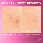 L'Oreal Paris Melasyl hyperpigmentation and sunspot removal serum packaging