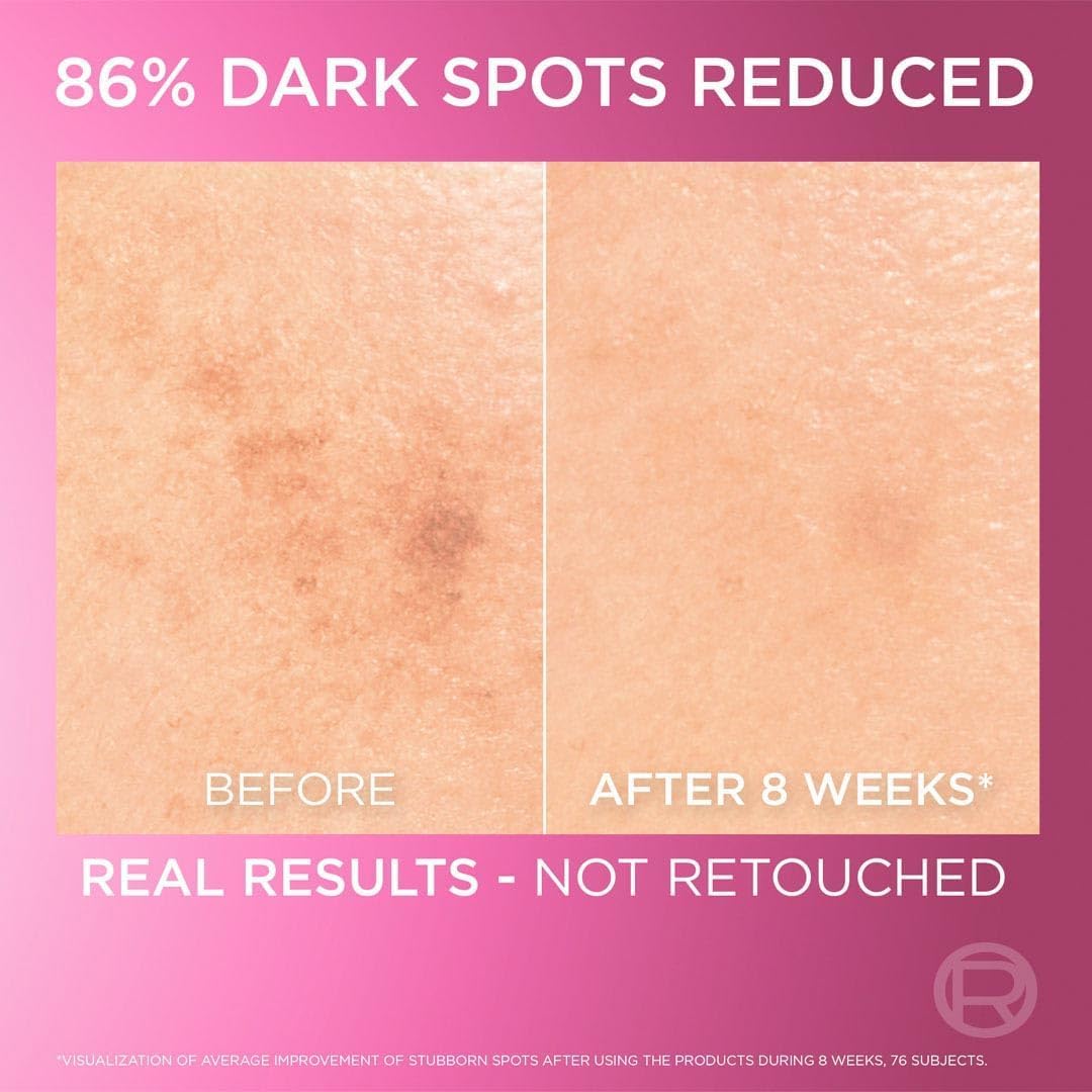 L'Oreal Paris Melasyl hyperpigmentation and sunspot removal serum packaging