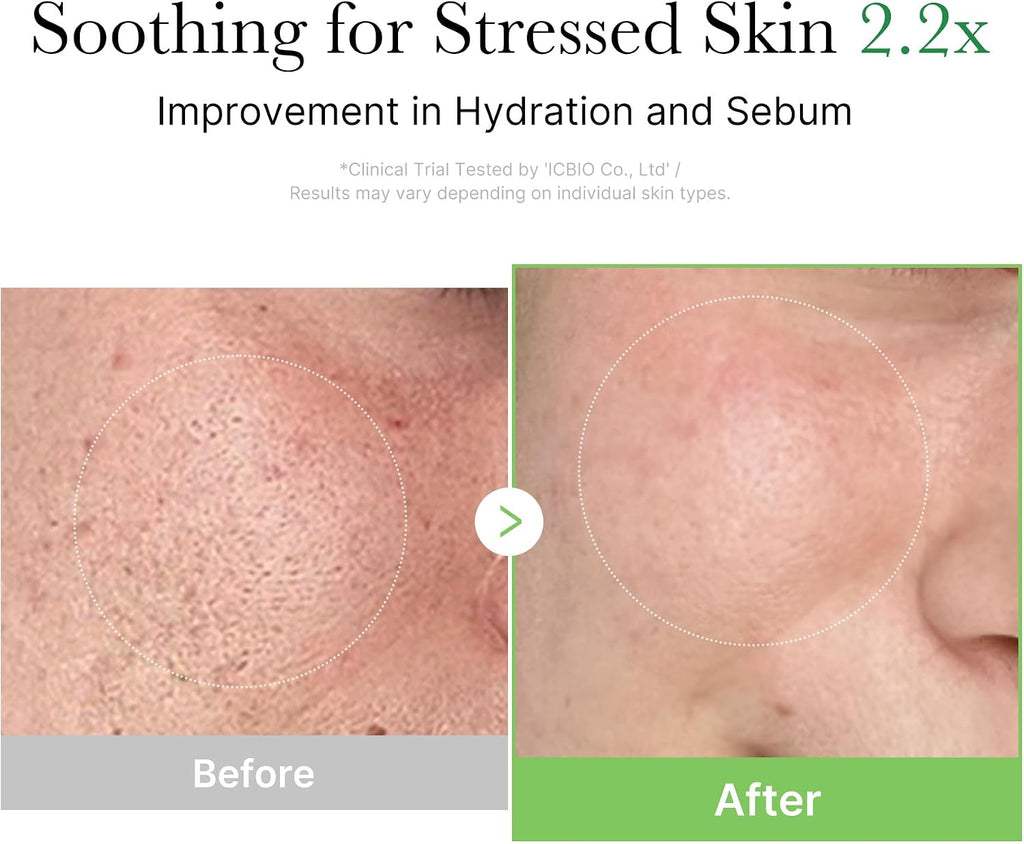 Medicube Exosome Cica Tea Tree Cream application on skin