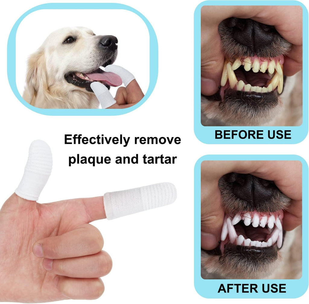 PenVinoo finger toothbrush being worn on fingers