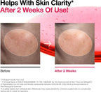 Anua 2% BHA + 10% Niacinamide Skin Booster Duo - Image 5