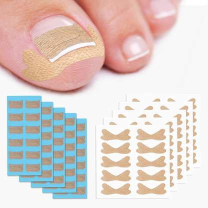 Bezox ingrown toenail corrector patches kit front view