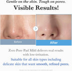 Medicube zero pore pad mild close up of dual textured pad surface