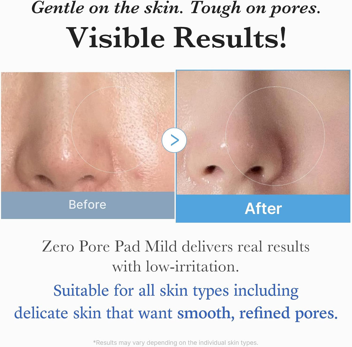 Medicube zero pore pad mild close up of dual textured pad surface