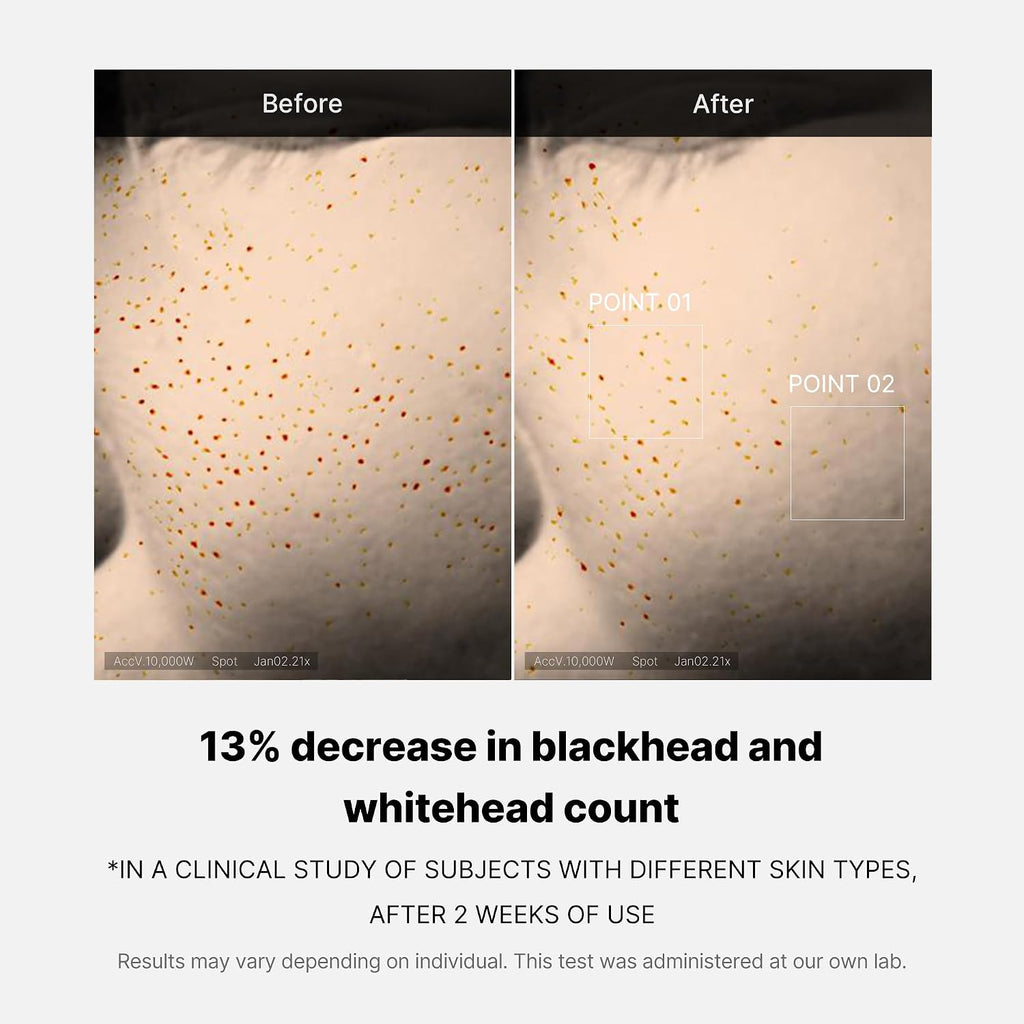 Medicube Zero Pore One-day Serum 1.01 fl.oz - Overnight Resurfacing Serum with Pore Tightening Complex - 15.2% AHA+BHA+PHA & 2% Niacinamide - 10.8% reduction in pore appearance after one day of use - Image 6