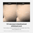 Medicube Zero Pore One-day Serum 1.01 fl.oz - Overnight Resurfacing Serum with Pore Tightening Complex - 15.2% AHA+BHA+PHA & 2% Niacinamide - 10.8% reduction in pore appearance after one day of use - Image 6