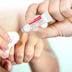 Applying Biolife WoundSeal powder to minor wound