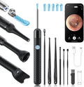Loyker X6 Ear Wax Removal Tool front view with camera lens visible