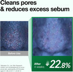 Heartleaf Pore Control Cleansing Oil by Anua for Unisex - 6.76 oz Cleanser - Image 6
