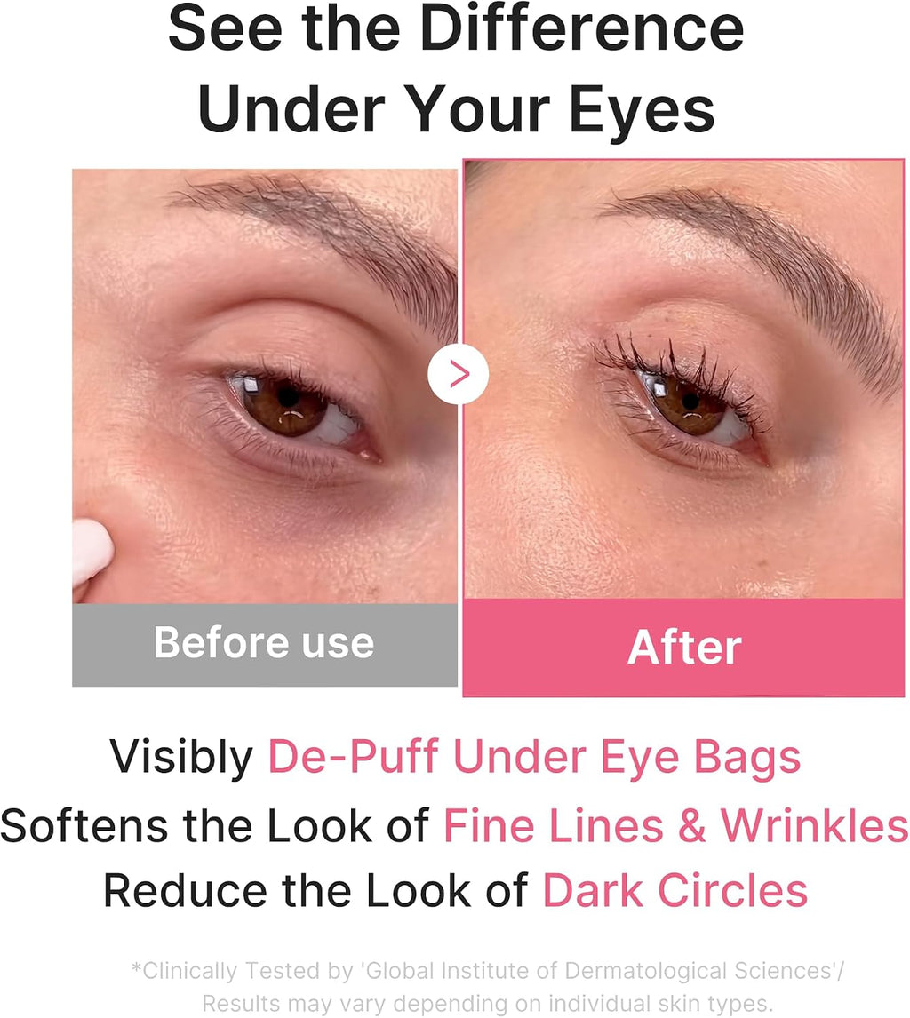Medicube Jelly Eye Mask showing application under the eyes