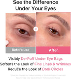Medicube Jelly Eye Mask showing application under the eyes
