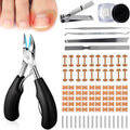 Gleva Cosmetics Ingrown Toenail Removal Kit front view showing the complete professional foot care set including stainless steel clippers and patches.