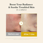 medicube Jelly Mist Serum with Kojic Acid Turmeric, Brightening Face Mist - Image 4