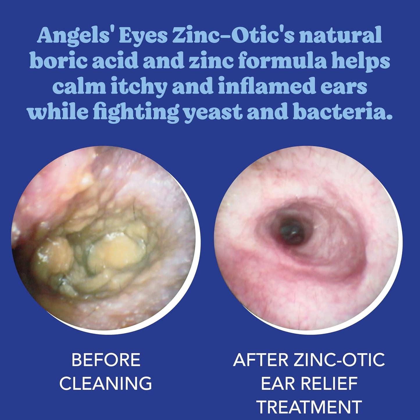 Side view of Angels' Eyes Zinc-Otic bottle showing natural formula benefits