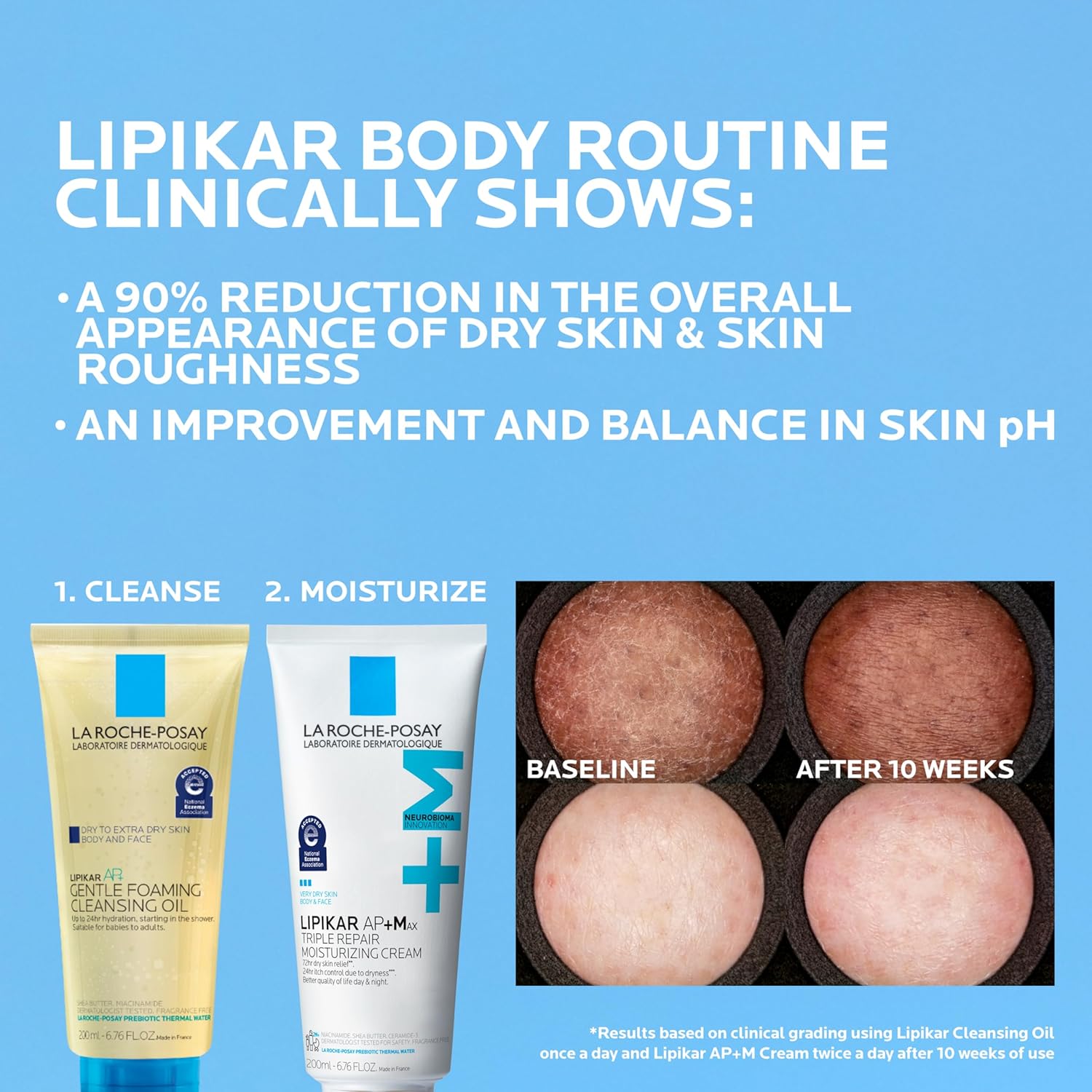 Applying La Roche-Posay Lipikar Baume AP+MAX lotion onto dry hands for itch control