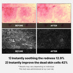 Medicube Super Cica facial pads application demonstration