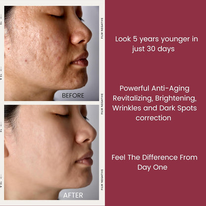 Pure 2.5% Retinol Serum Capsules. Look 5 Years Younger In 30 Days. Powerful Anti -Aging, Deep Hydration, Brightening, Reduce Acne, Dark Spots & Wrinkles (30 Count) - Image 9