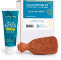 Gilden Tree Foot Callus Remover Kit front view showing urea cream tube and terra cotta stone.