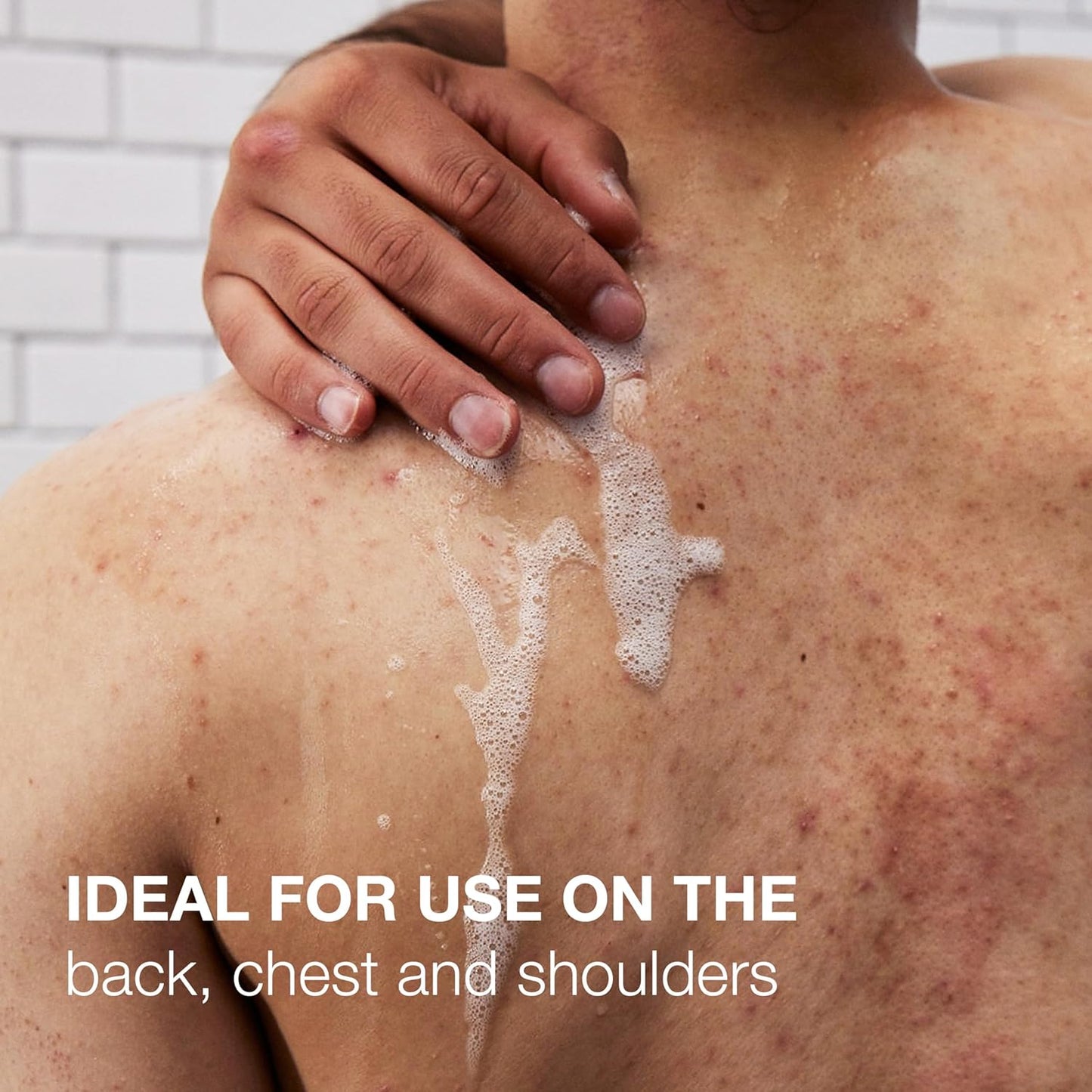 Neutrogena body acne cleanser clear plastic bottle packaging ideal for back chest and shoulder breakout care.