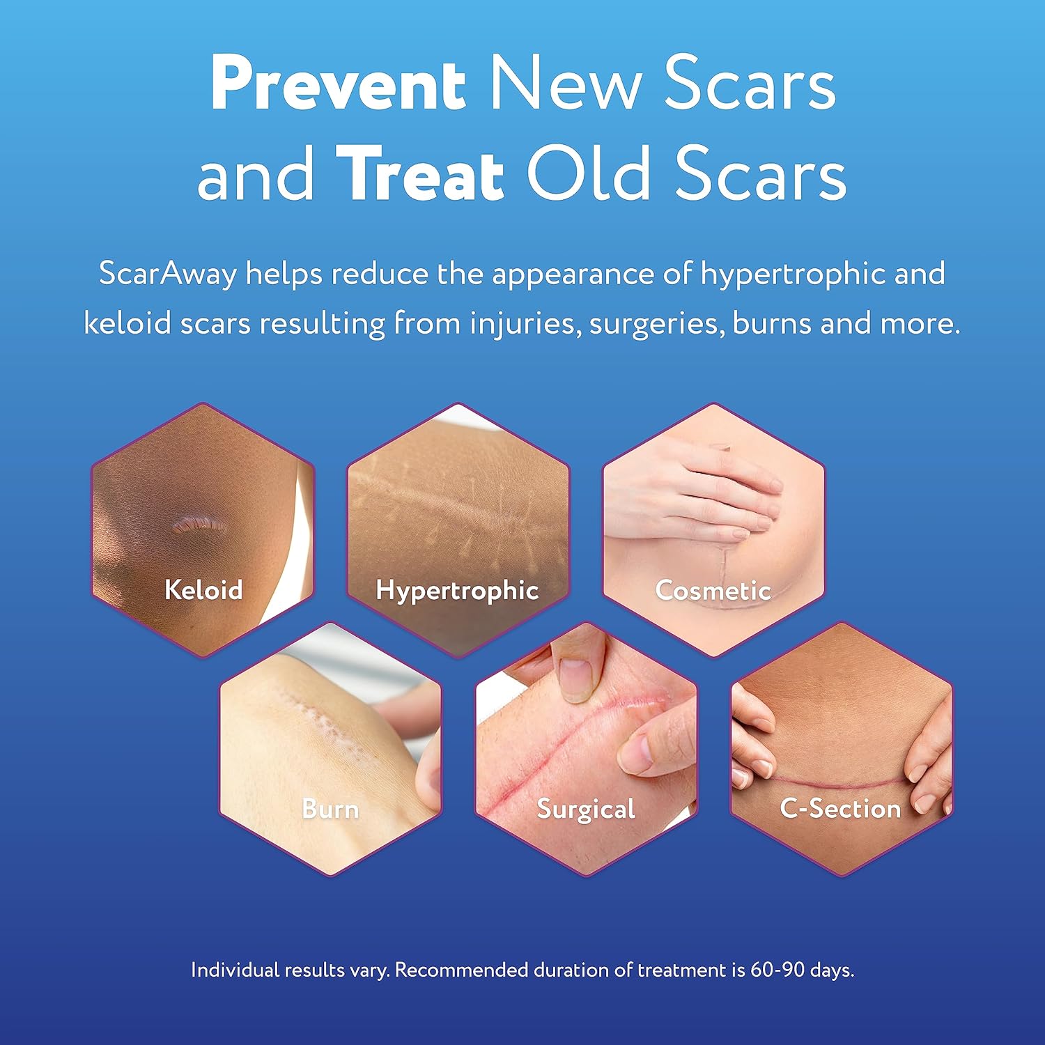 ScarAway advanced formula gel tube showing the application nozzle for precise use on face and body.
