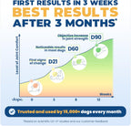 Premium veterinary formulated UC-II collagen chews for canine mobility