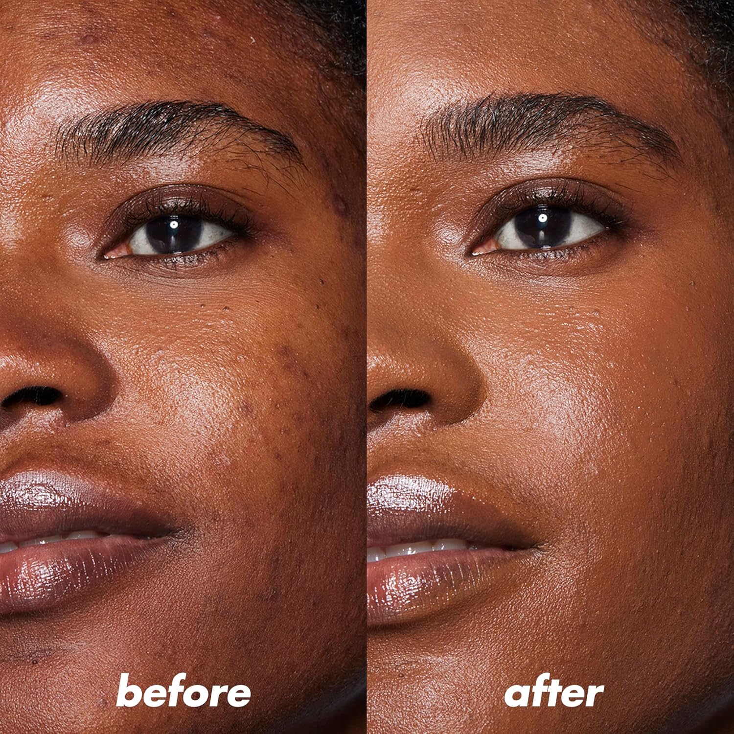 Hydrating camo color correcting makeup infused with hyaluronic acid