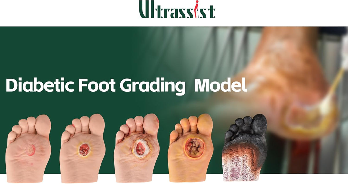 Ultrassist medical simulator showing various stages of skin damage and pathological changes.