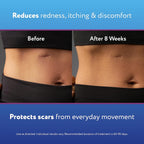 Back label of ScarAway 20 Grams gel showing ingredients and official usage instructions.