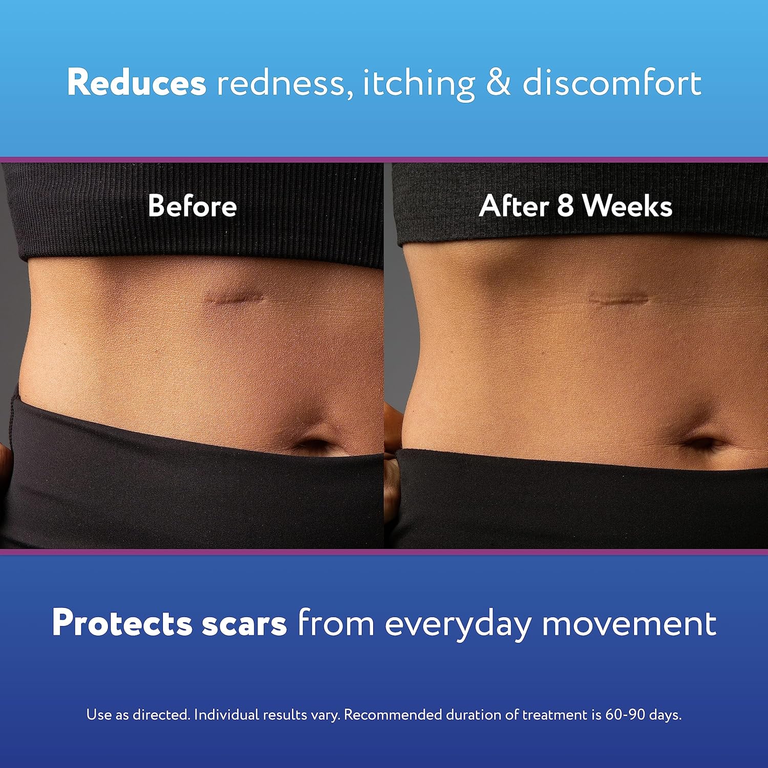Back label of ScarAway 20 Grams gel showing ingredients and official usage instructions.
