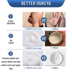 Oukeya 40 percent urea cream packaging displayed for daily skincare routine