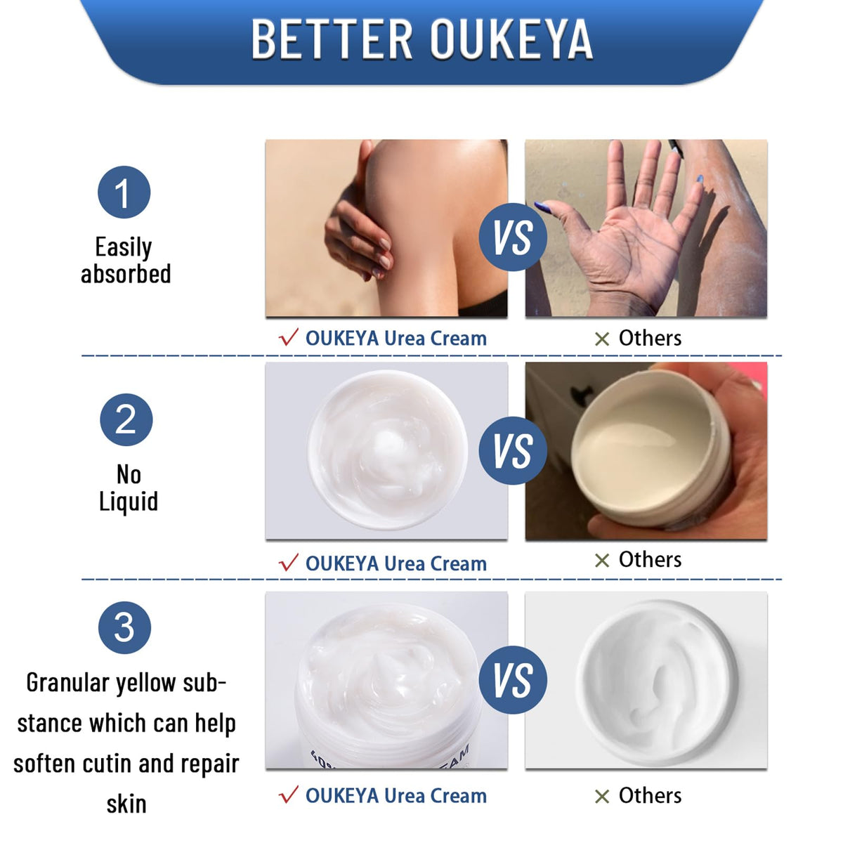 Oukeya 40 percent urea cream packaging displayed for daily skincare routine