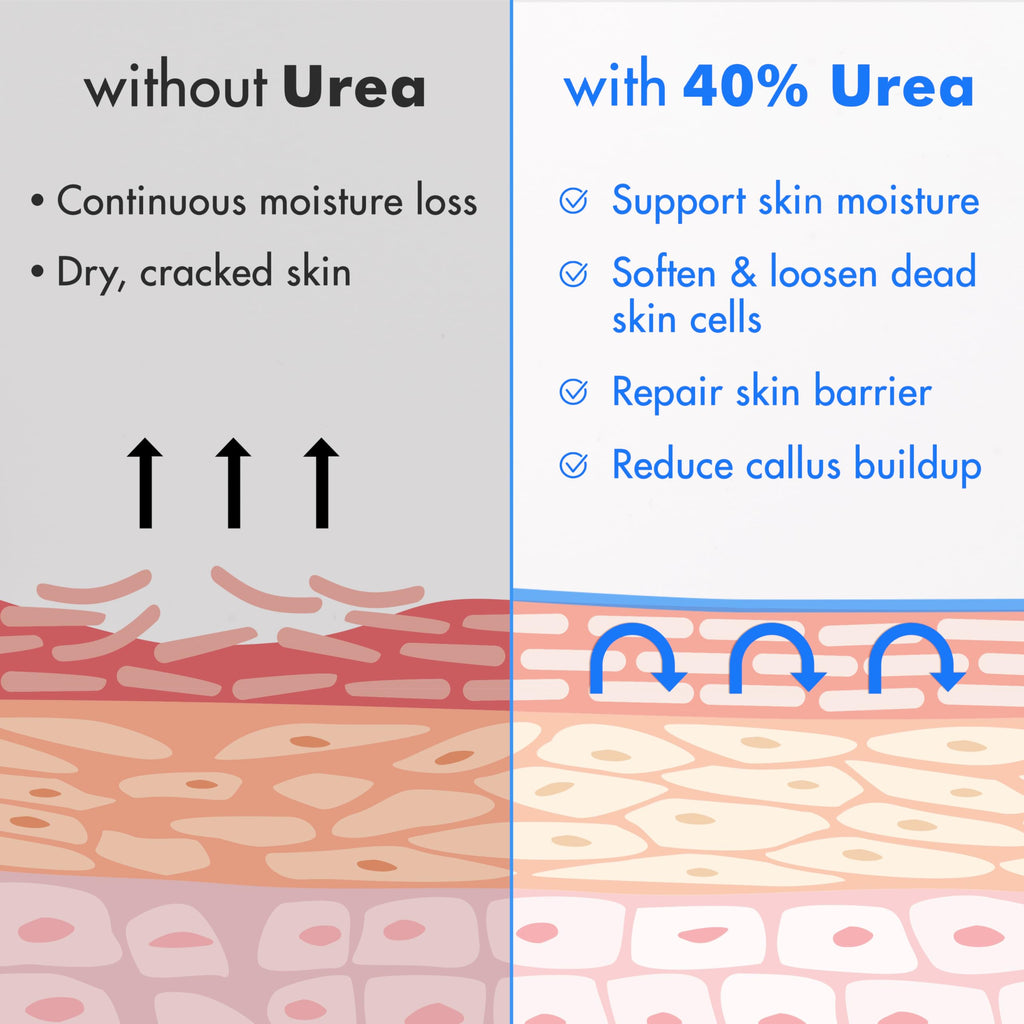 Ebanel dry cracked heel treatment application demonstration