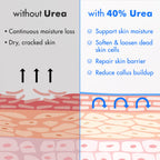 Ebanel dry cracked heel treatment application demonstration