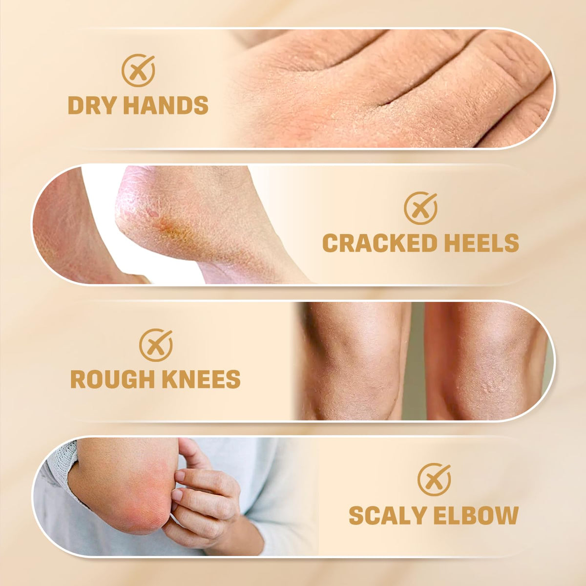 Clyecfra 60 percent urea cream lifestyle shot for hand care