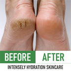 PurOrganica cracked heel treatment jar open view